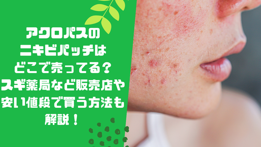アクロパスのニキビパッチはどこで売ってる?スギ薬局など販売店や安い値段で買う方法も解説!